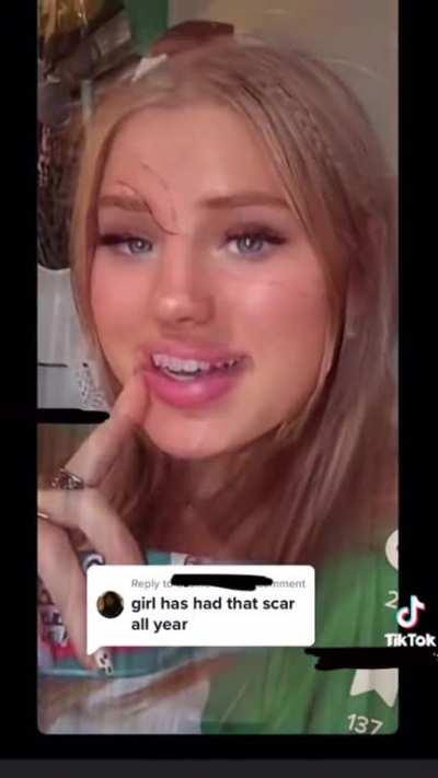 New trend… fake scars drawn on the face