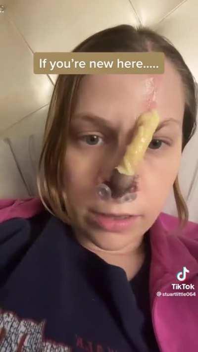 Saw the dissolved septum posts and wanted to share this woman’s story. At one point she was snorting up to an ounce of coke a day. Really respect her for sharing her story and being so honest.