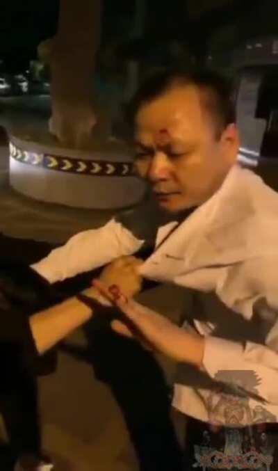 Man in China bites his opponent's finger off.