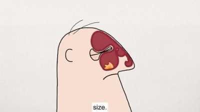 How Sinus Infection Causes Headache