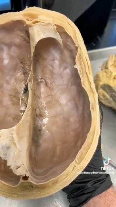 Phenomenal view of the inside of the top of our skulls [NSFW]
