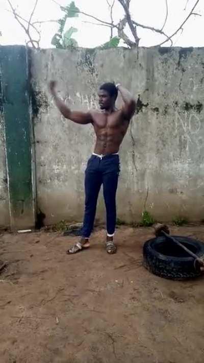 This Nigerian lad with vitiligo on his lips...thoughts?