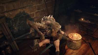 new bottom surgery just dropped