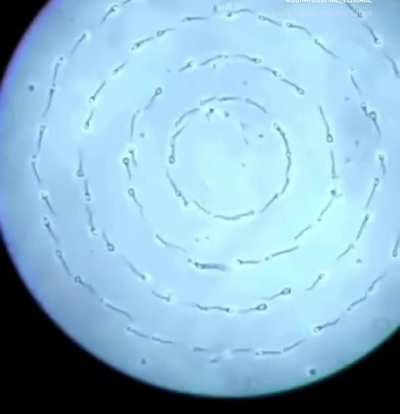 Gays, I got my sperm results back and this is the video - is this normal, or Mayhem?