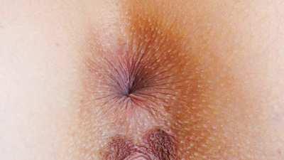 Zooming in on Kelly Collins' starfish