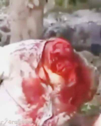 ***⚠WARNING⚠***GRAPHIC AS FUCK CONTENT*** again not for pussies. Don't be bitches and cry after clicking. You've been warned about the content, be adults fuckers.