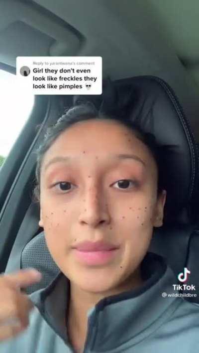 girl gets freckles tattooed on her face to make herself look 