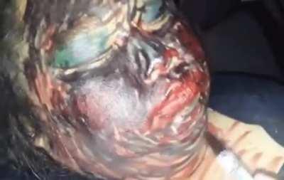 Falling asleep around friends