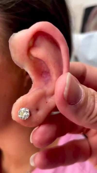 How realistic prosthetics have become.