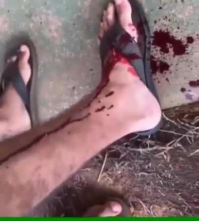 Idiot with...hammer.