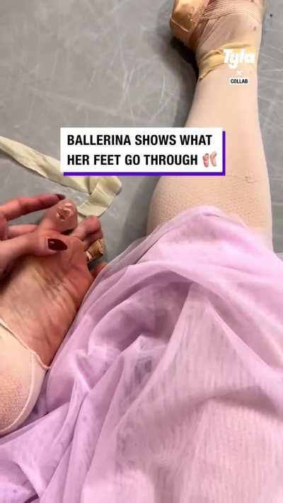 This Ballerina's feet