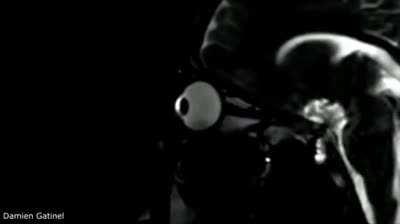 An MRI scan of what it looks like when you rub your eyes.