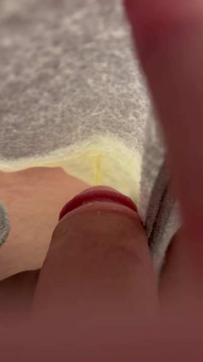 Okay last time pissing my pants for a few days, what should I do next?