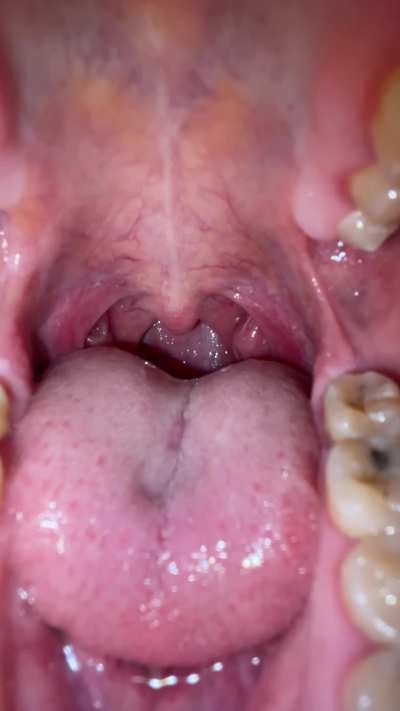 w0uld you climb in willingly? or would you try and escape my trap of 4 mouth?