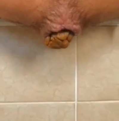 My hot hard poop constipated 