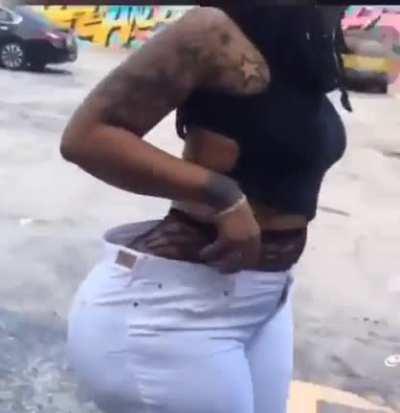 Found on another sub so sorry if a repost. What kind of drugs was her surgeon on? This poor woman.