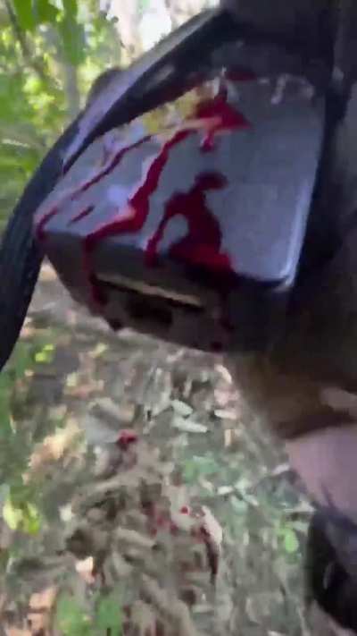 POW  from Ukrainian soldier who gets shot in the head but manages to  evacuate