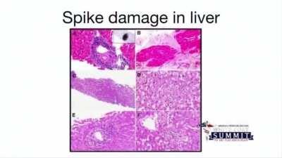 Scientist shows vaccine effects in autopsies. Don't believe it? See for yourself, if you want.