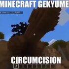 Circumcision 😳✂️🍆