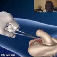 Found this on Discord.