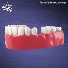 Here's how some common dental procedures carried out [Part 2]