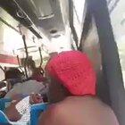 Woman with alopecia gets bullied on the bus