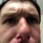 Guy pulls a huge thing out of his face