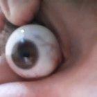 Thanks, ı hate my ability to pop my eye out